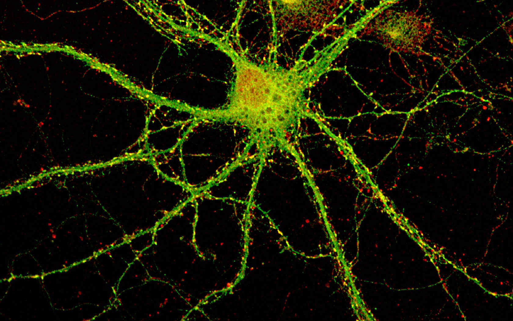Brain