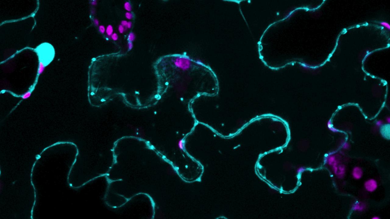 The new study emphasizes the importance of the enzyme BIK1, fluoresced in blue, in plants’ chemical defenses. Ugrappa Nagalakshmi 