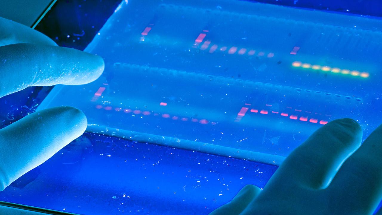 Sifting through the 3.2 billion base pairs in the human genome is no easy feat. To assist the process, scientists are using computers. Jacopo Werther Genome sequencing