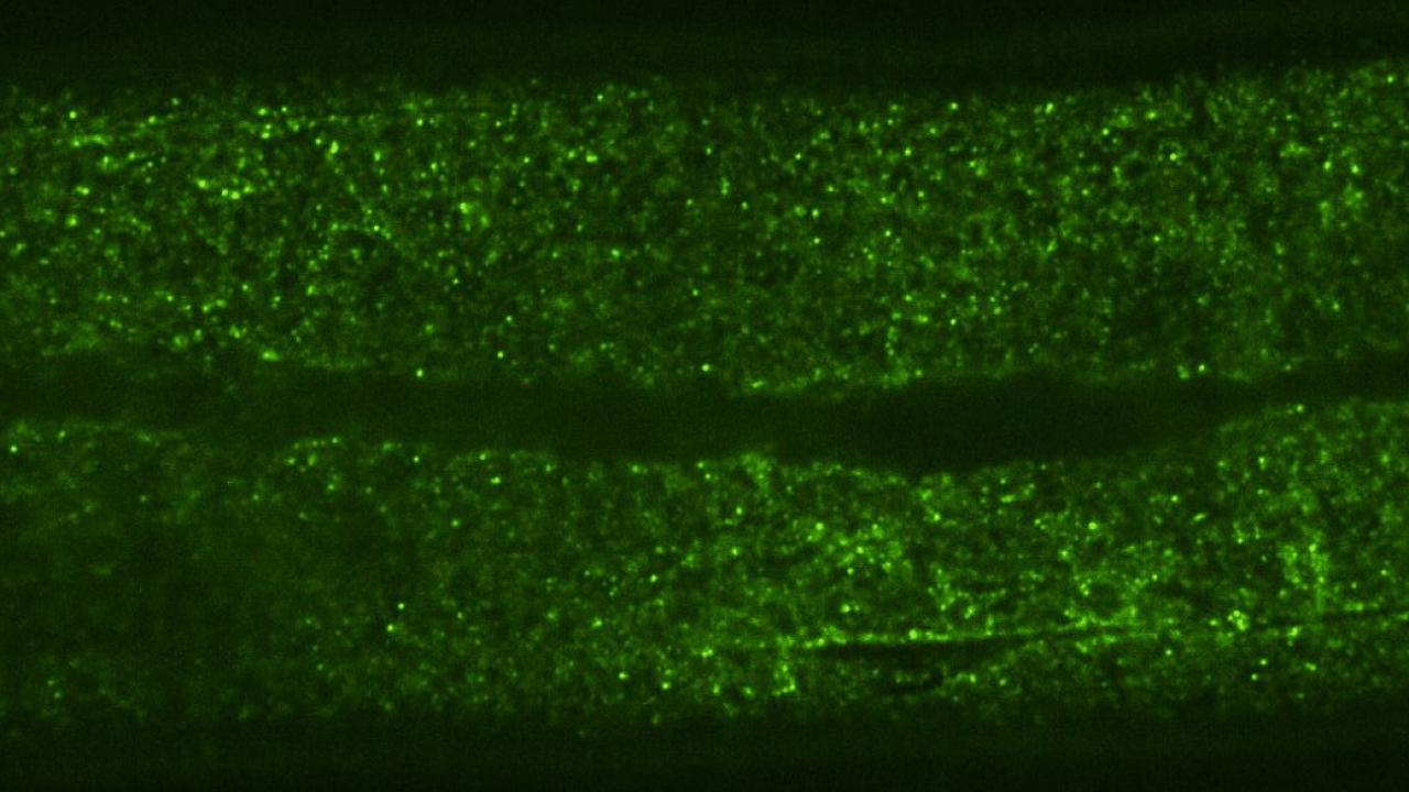 Microscope image shows fluorescent green GEM particles scattered across worm tissue.