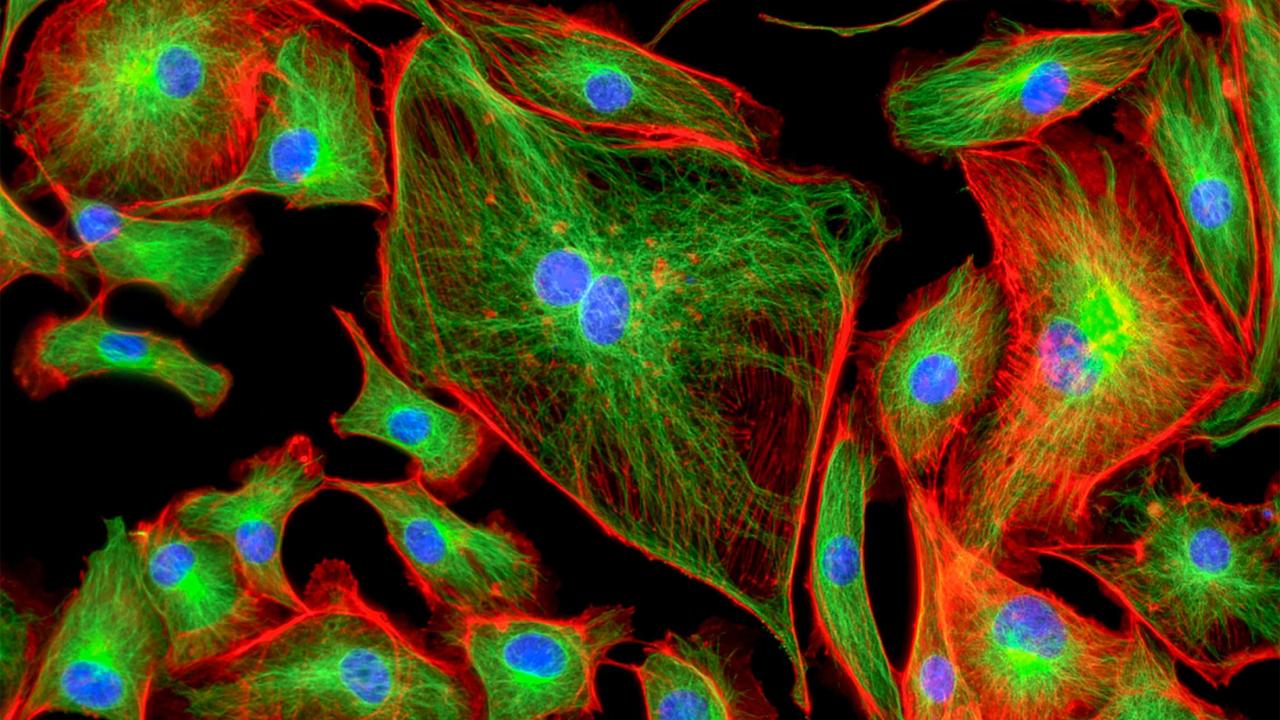 Bovine epithelial cells in red and green