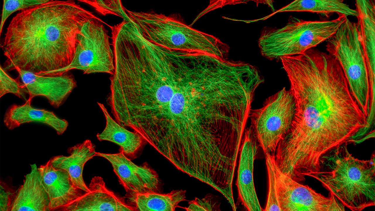 Heart tissue micrograph in red and green