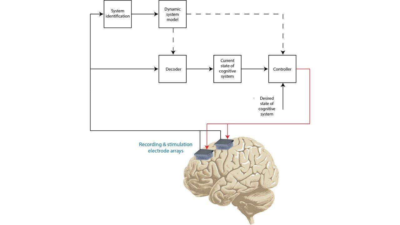 Brain and implant diagram
