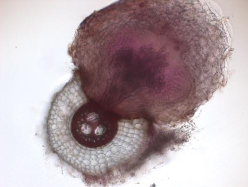 Cross-section of a sorghum root (concentric circles, bottom left) with a witchweed plant attached. (Karolina Czarnecki / UC Davis)