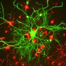Researchers hope to gain a better visual perspective of the molecular mechanisms of the brain's continual rearrangement of neuronal connections, known collectively as brain plasticity. Gerry Shaw