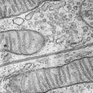 Long, narrow mitochondria with visible cristae shown under electron microscopy at 28000x magnification